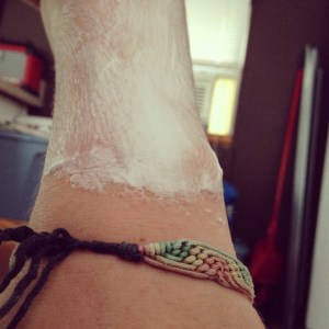 It started so innocent...